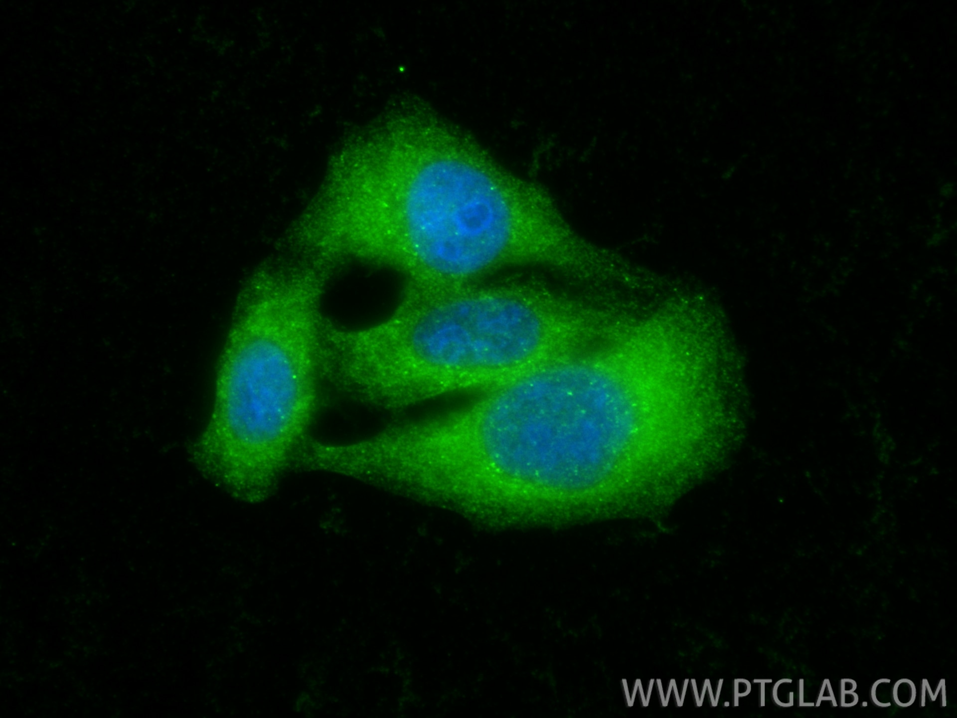 IF Staining of HepG2 using 12434-1-AP Immunofluorescence (IF) / fluorescent staining of HepG2 cells using STAM Polyclonal antibody (12434-1-AP)