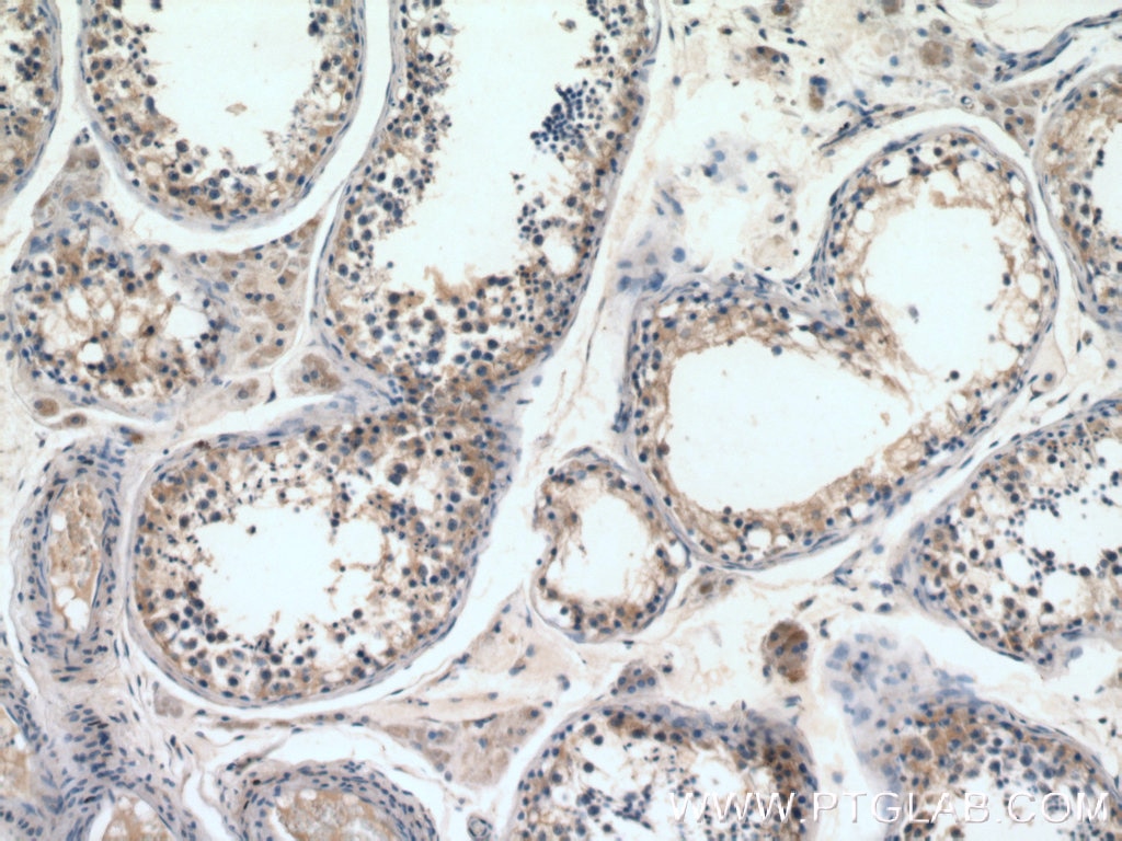 Immunohistochemistry (IHC) staining of human testis tissue using STAM Polyclonal antibody (12434-1-AP)