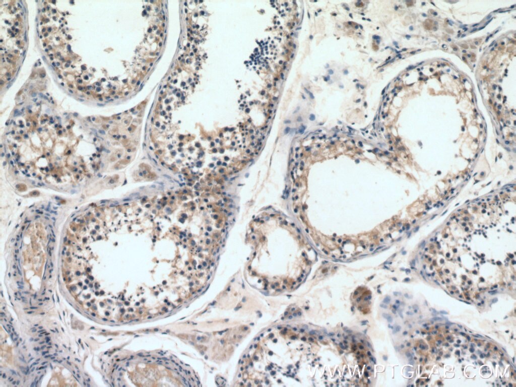 IHC staining of human testis using 12434-1-AP