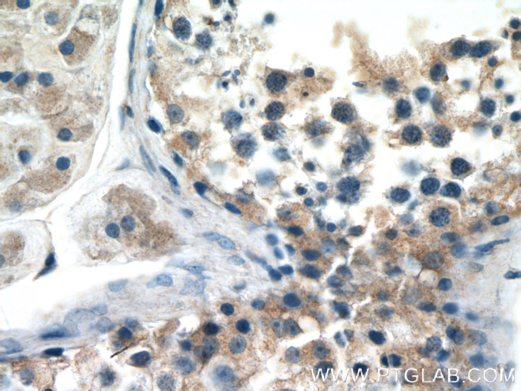Immunohistochemistry (IHC) staining of human testis tissue using STAM Polyclonal antibody (12434-1-AP)