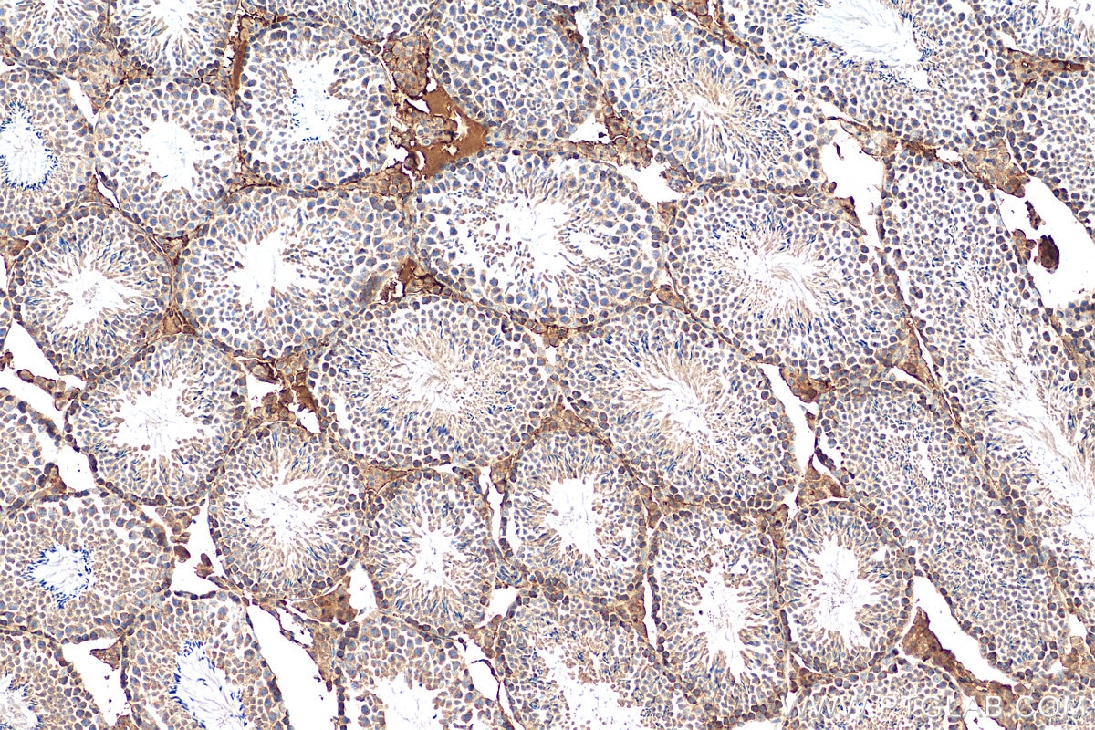 Immunohistochemistry (IHC) staining of mouse testis tissue using STAM Polyclonal antibody (12434-1-AP)