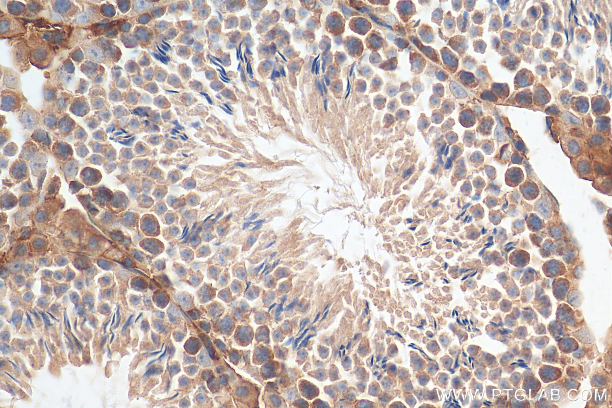 Immunohistochemistry (IHC) staining of mouse testis tissue using STAM Polyclonal antibody (12434-1-AP)