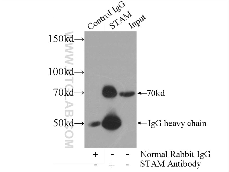 Immunoprecipitation (IP) experiment of PC-3 cells using STAM Polyclonal antibody (12434-1-AP)