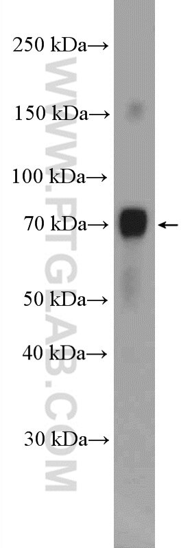 Western Blot (WB) analysis of mouse brain tissue using STAM Polyclonal antibody (12434-1-AP)