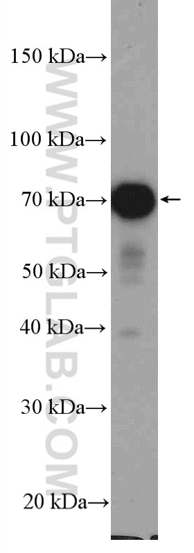 Western Blot (WB) analysis of Y79 cells using STAM Polyclonal antibody (12434-1-AP)