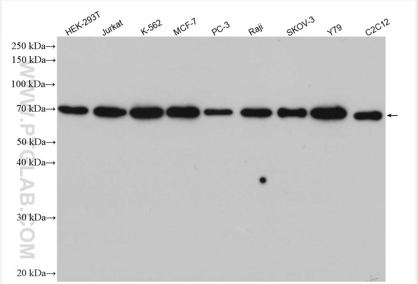 Western Blot (WB) analysis of various lysates using STAM Polyclonal antibody (12434-1-AP)
