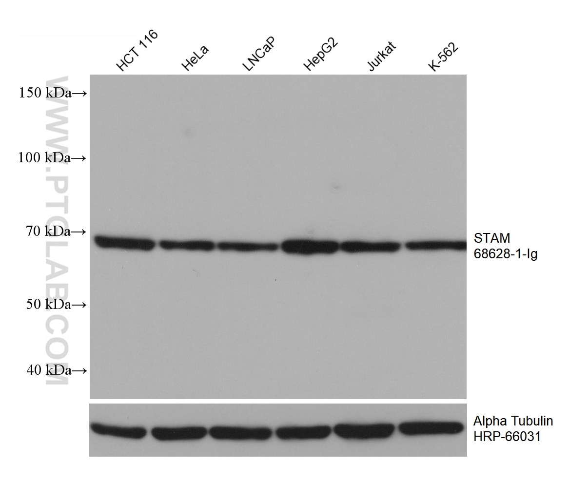 Western Blot (WB) analysis of various lysates using STAM Monoclonal antibody (68628-1-Ig)