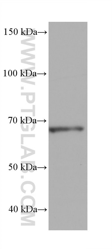 Western Blot (WB) analysis of RAW 264.7 cells using STAM Monoclonal antibody (68628-1-Ig)