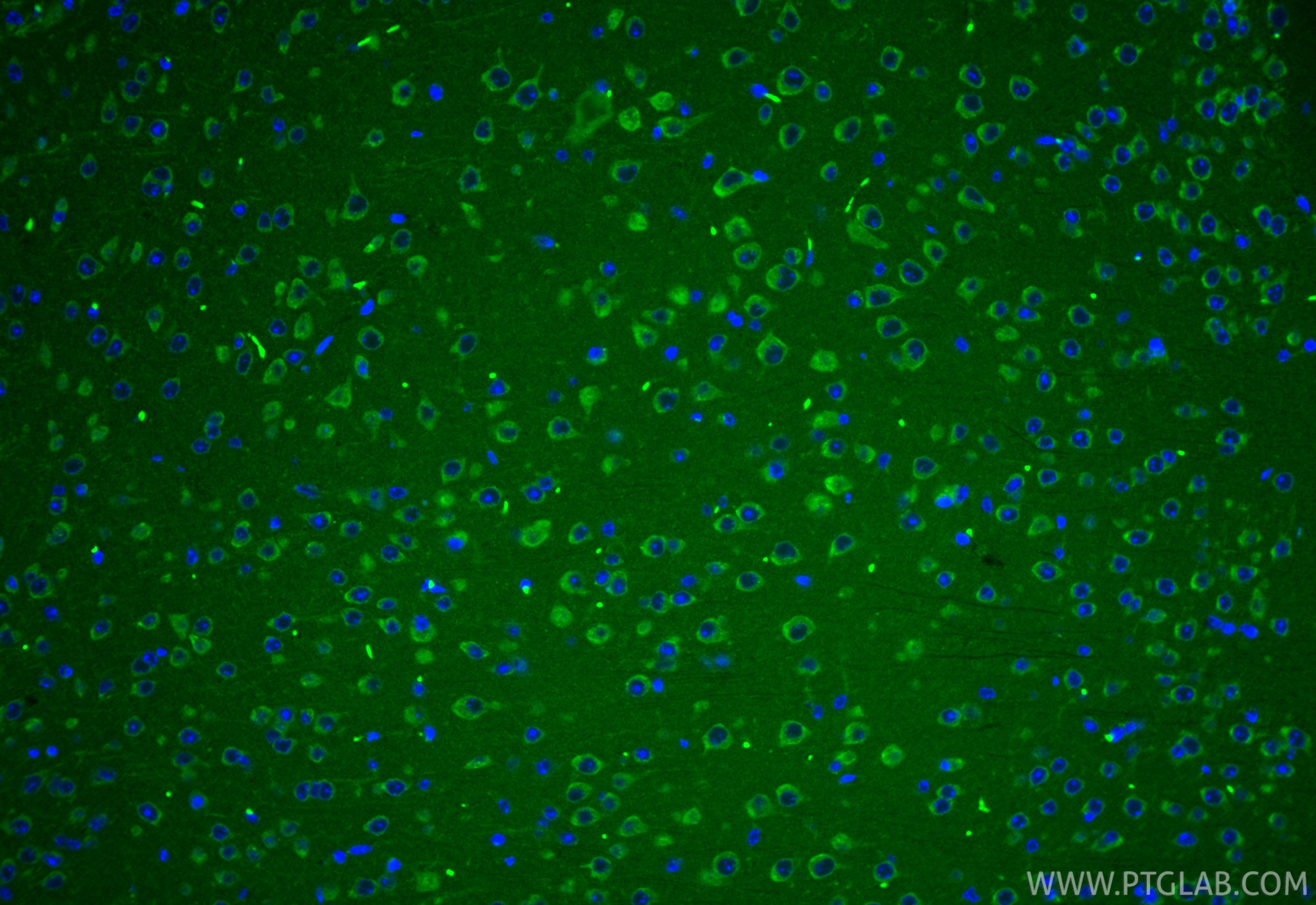 IF Staining of mouse brain using CL488-12434 Immunofluorescence (IF) / fluorescent staining of mouse brain tissue using CoraLite® Plus 488-conjugated STAM Polyclonal anti (CL488-12434)