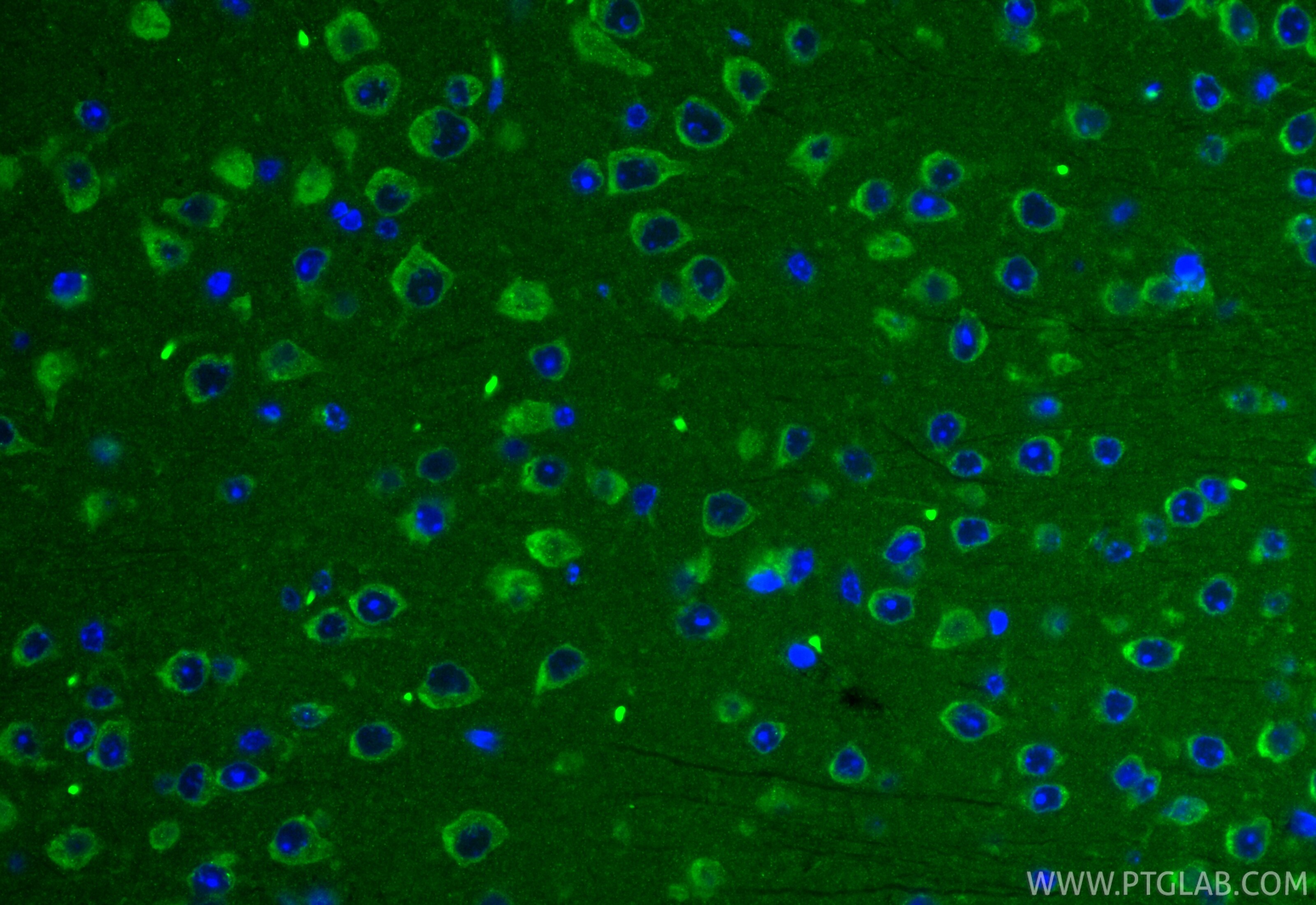 IF Staining of mouse brain using CL488-12434 Immunofluorescence (IF) / fluorescent staining of mouse brain tissue using CoraLite® Plus 488-conjugated STAM Polyclonal anti (CL488-12434)