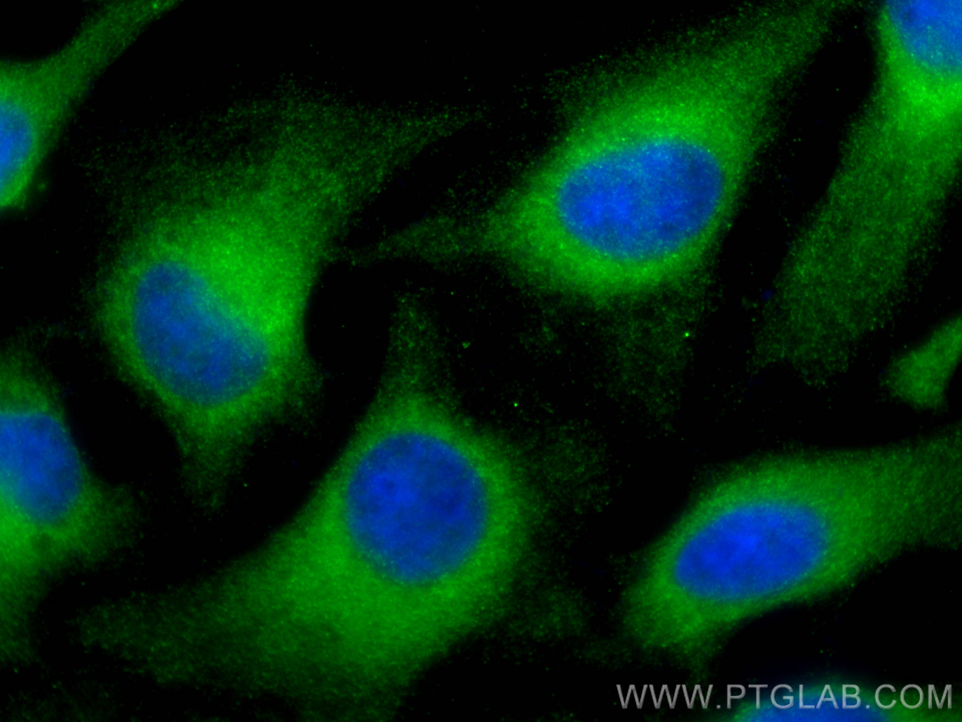 Immunofluorescence (IF) / fluorescent staining of HeLa cells using STAM2 Polyclonal antibody (13009-1-AP)