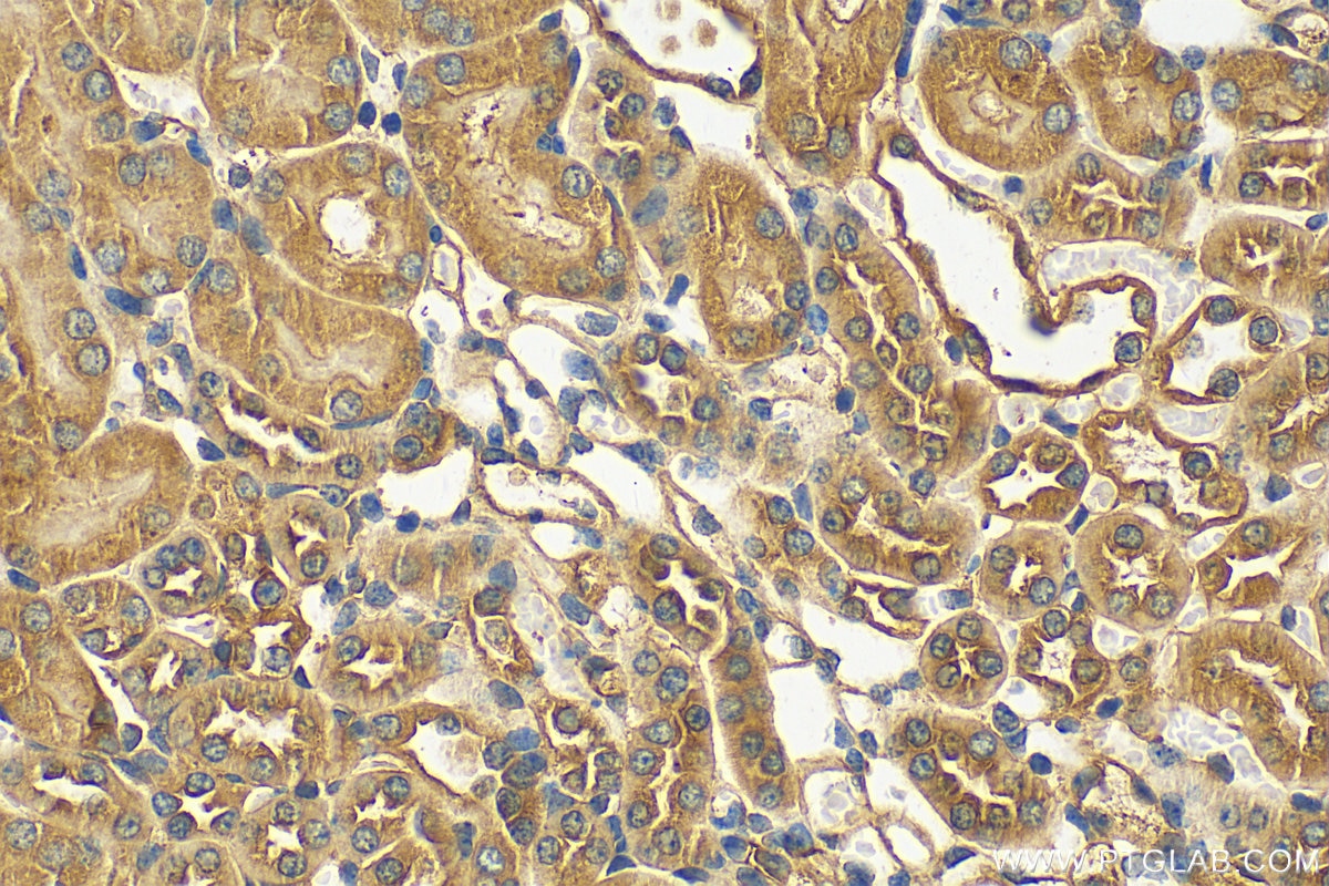 Immunohistochemistry (IHC) staining of mouse kidney tissue using STAM2 Polyclonal antibody (13009-1-AP)