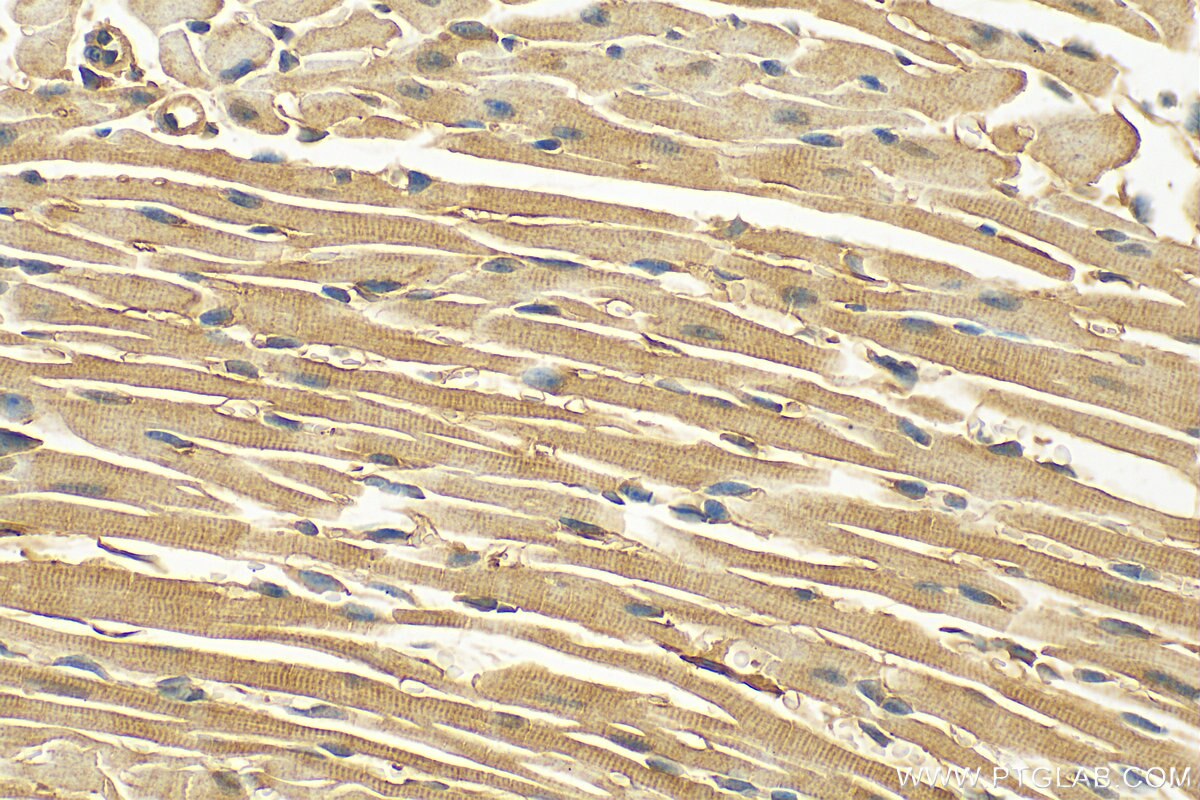 Immunohistochemistry (IHC) staining of mouse heart tissue using STAM2 Polyclonal antibody (13009-1-AP)