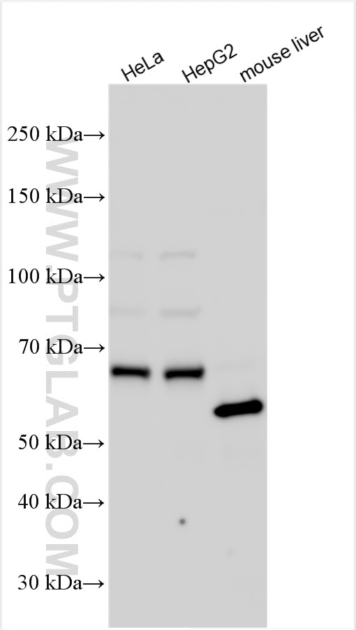 Western Blot (WB) analysis of various lysates using STAM2 Polyclonal antibody (13009-1-AP)