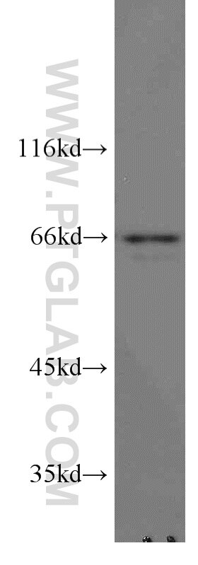 Western Blot (WB) analysis of mouse brain tissue using STAM2 Polyclonal antibody (13009-1-AP)