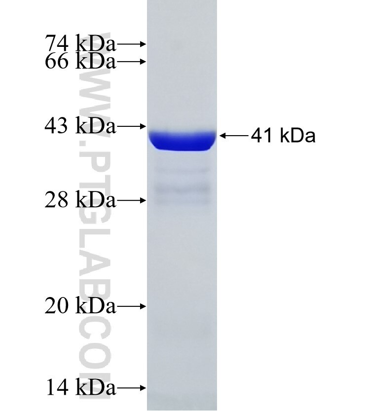 STAM2 fusion protein Ag31862 SDS-PAGE