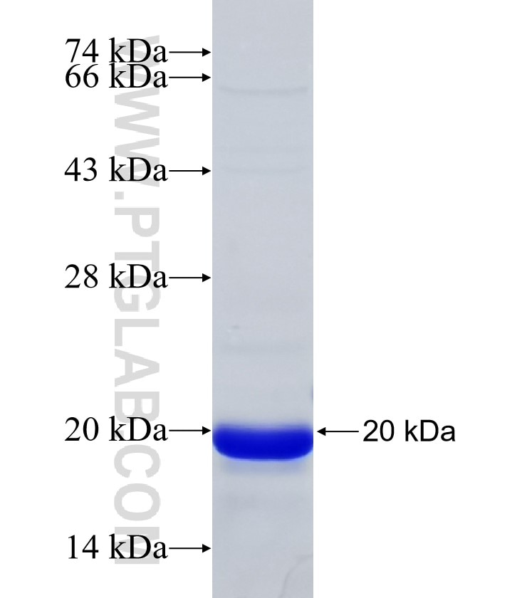 STAM2 fusion protein Ag31874 SDS-PAGE STAM2 fusion protein Ag31874 SDS-PAGE