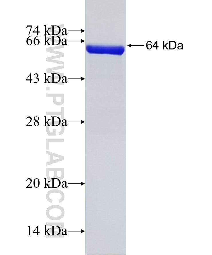 STAM2 fusion protein Ag3698 SDS-PAGE