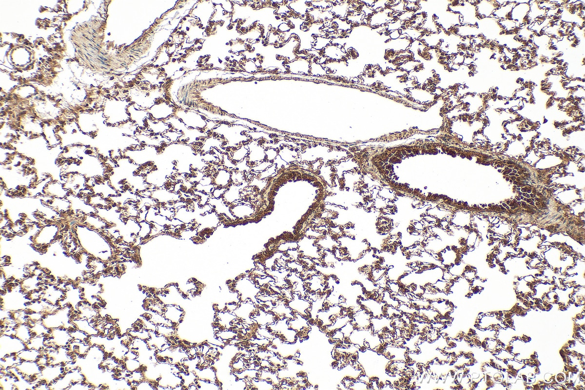 Immunohistochemistry (IHC) staining of rat lung tissue using STAMBP Polyclonal antibody (11346-1-AP)