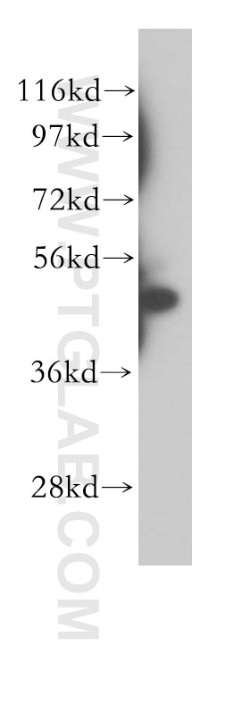 WB analysis of human placenta using 11346-1-AP