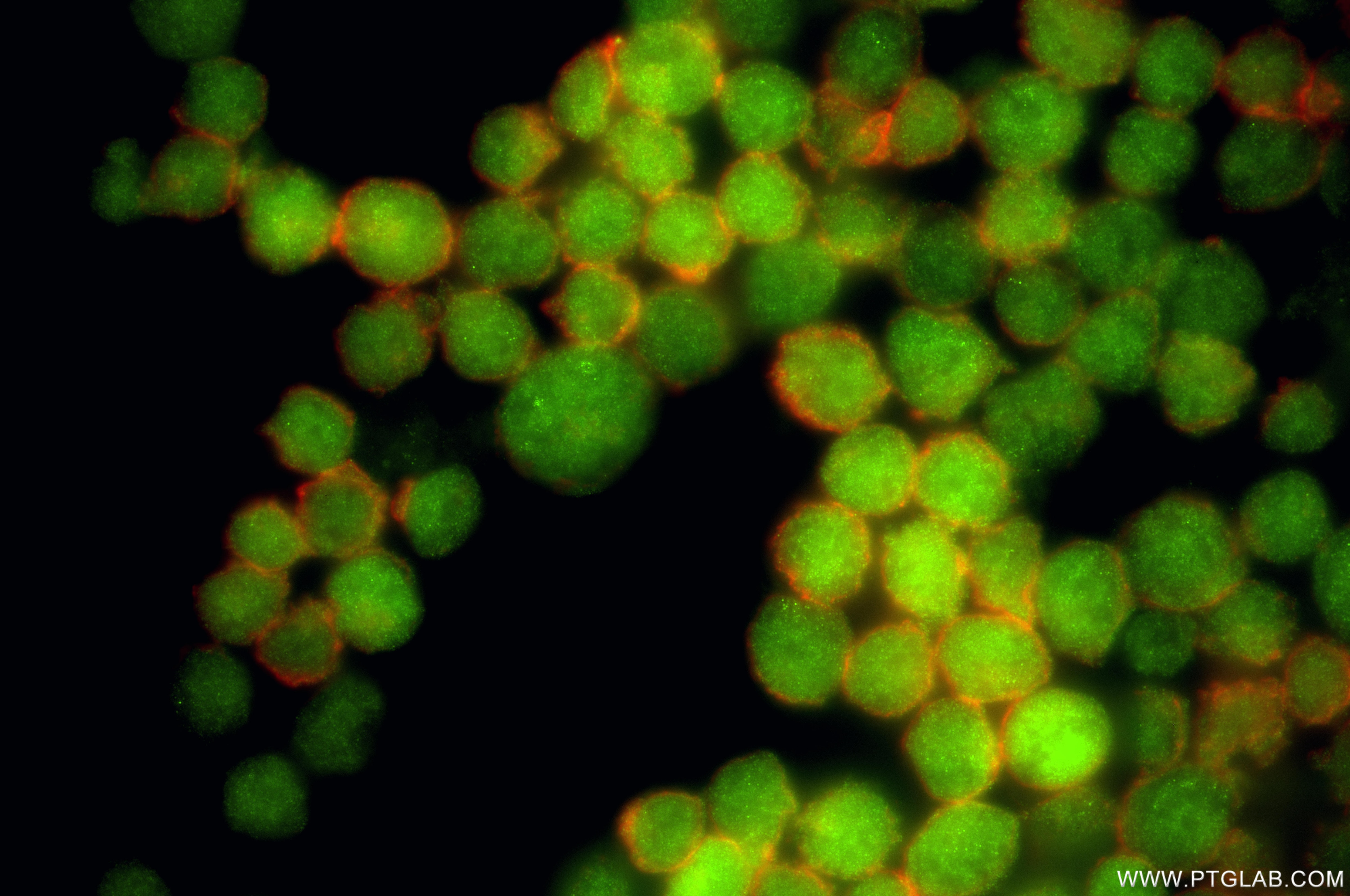 Immunofluorescence (IF) / fluorescent staining of K-562 cells using STAMBP Recombinant monoclonal antibody (86601-3-RR)