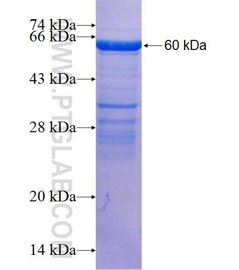 STAMBP fusion protein Ag1895 SDS-PAGE