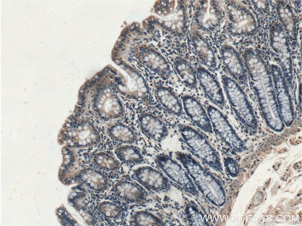 IHC staining of human colon using 27315-1-AP