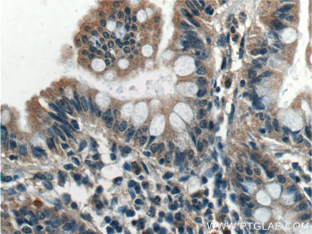 Immunohistochemistry (IHC) staining of human colon tissue using STAMBPL1 Polyclonal antibody (27315-1-AP)