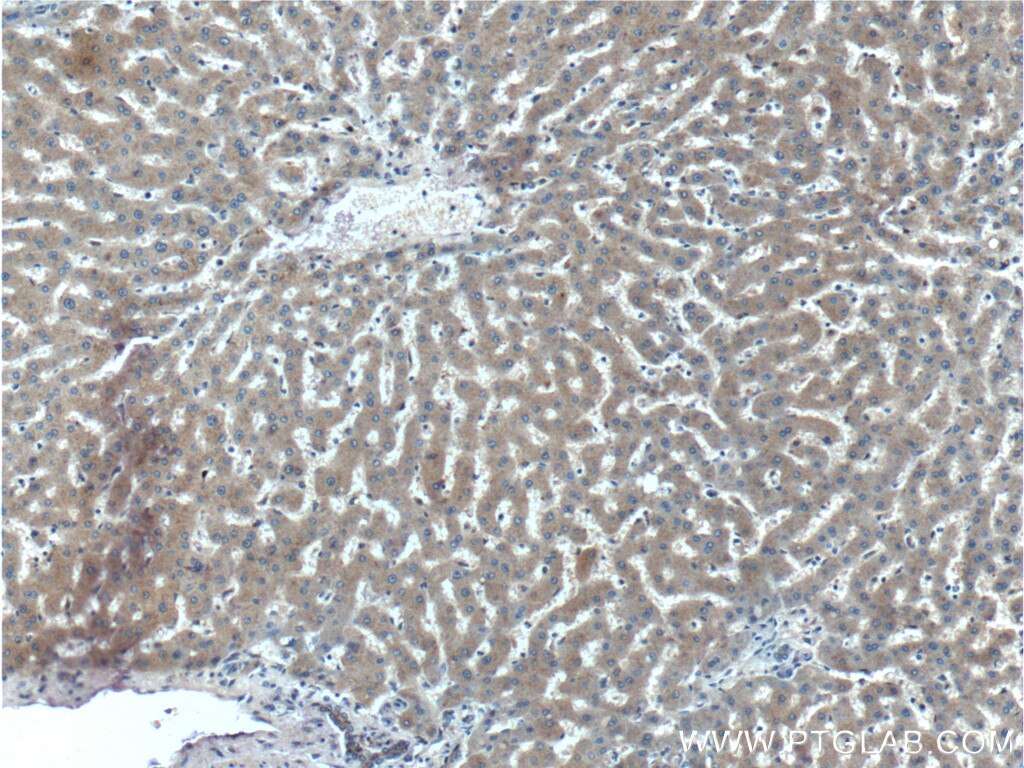 IHC staining of human liver using 27315-1-AP
