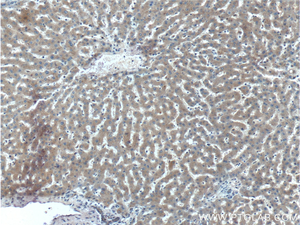 Immunohistochemistry (IHC) staining of human liver tissue using STAMBPL1 Polyclonal antibody (27315-1-AP)