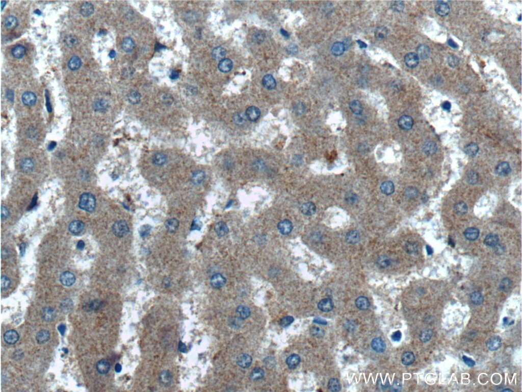 Immunohistochemistry (IHC) staining of human liver tissue using STAMBPL1 Polyclonal antibody (27315-1-AP)