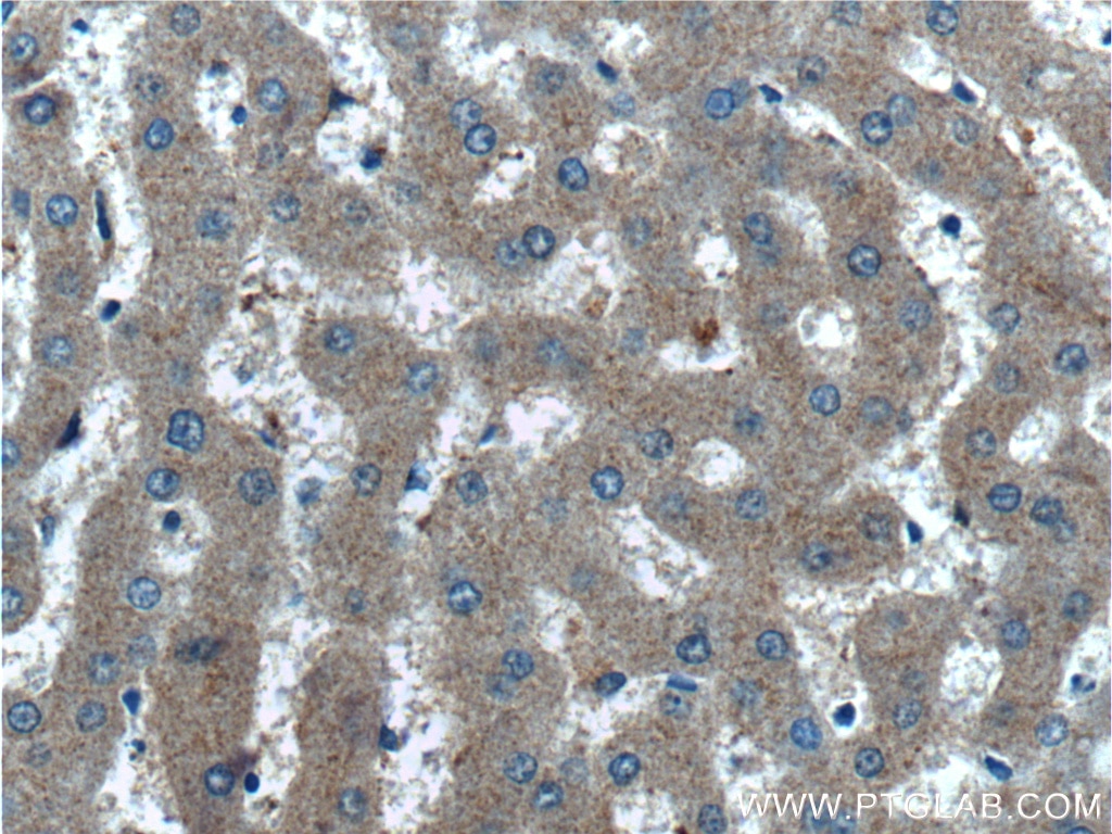 IHC staining of human liver using 27315-1-AP