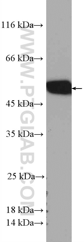 Western Blot (WB) analysis of A549 cells using STAMBPL1 Polyclonal antibody (27315-1-AP)