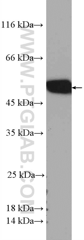 WB analysis of A549 using 27315-1-AP