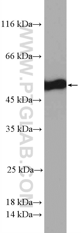 Western Blot (WB) analysis of HeLa cells using STAMBPL1 Polyclonal antibody (27315-1-AP)
