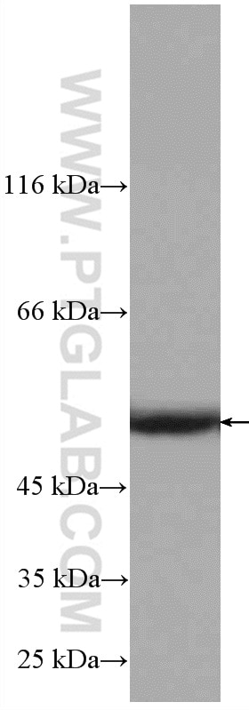 Western Blot (WB) analysis of human testis tissue using STAMBPL1 Polyclonal antibody (27315-1-AP)