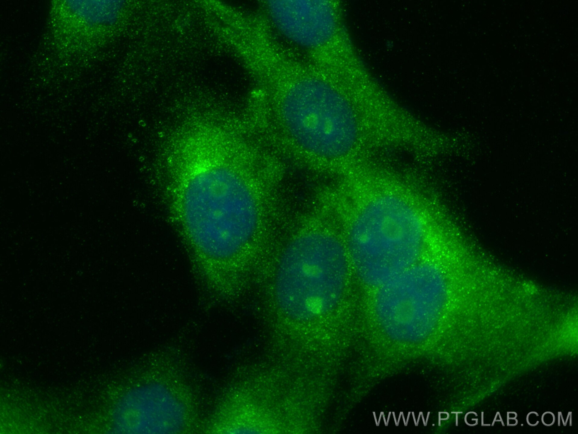 Immunofluorescence (IF) / fluorescent staining of A431 cells using STAP1 Polyclonal antibody (31732-1-AP)