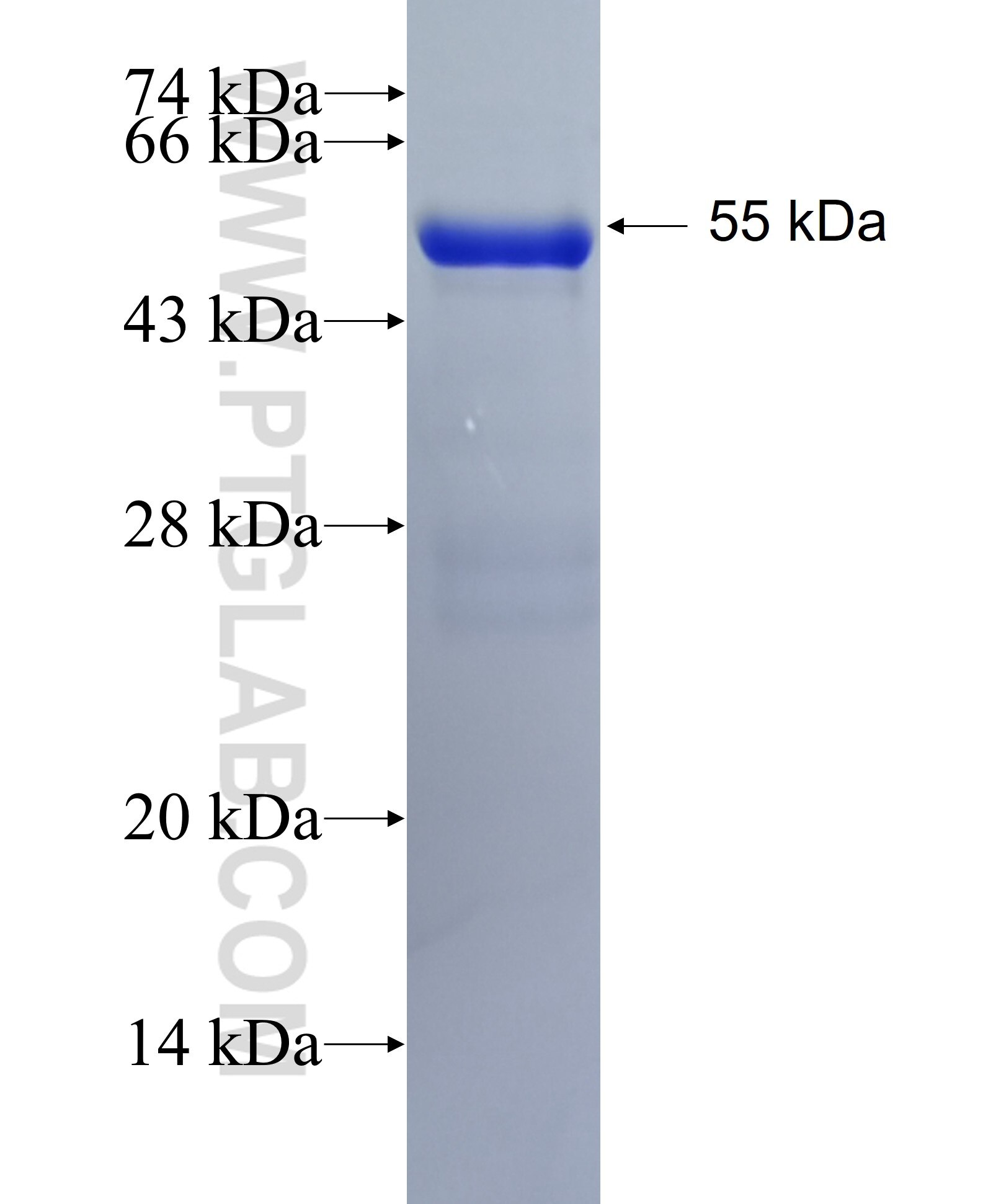 STAP2 fusion protein Ag28818 SDS-PAGE
