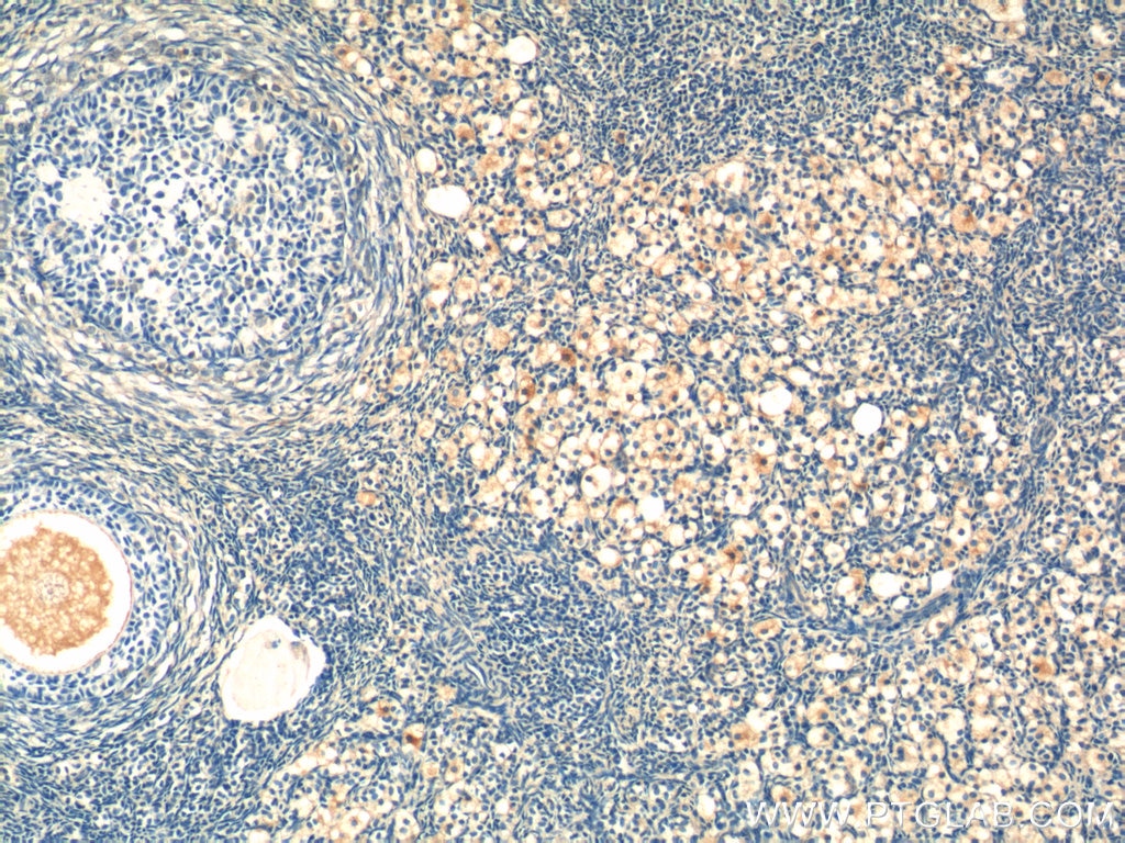 Immunohistochemistry (IHC) staining of human ovary tissue using STAR Polyclonal antibody (12225-1-AP)