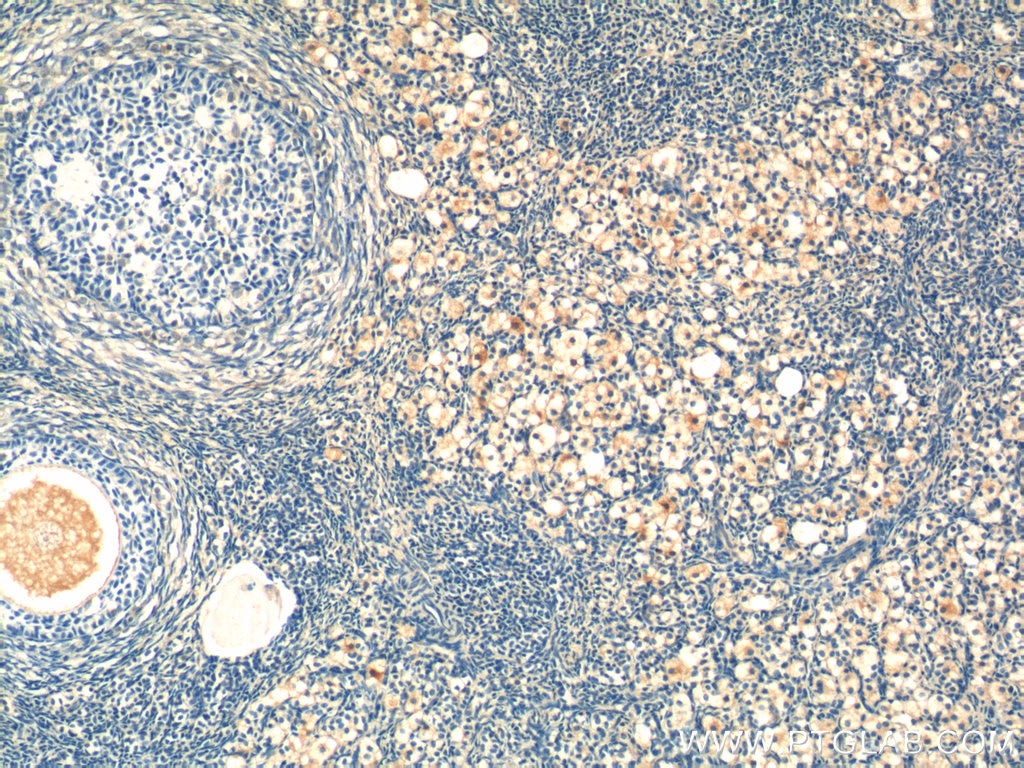 IHC staining of human ovary using 12225-1-AP