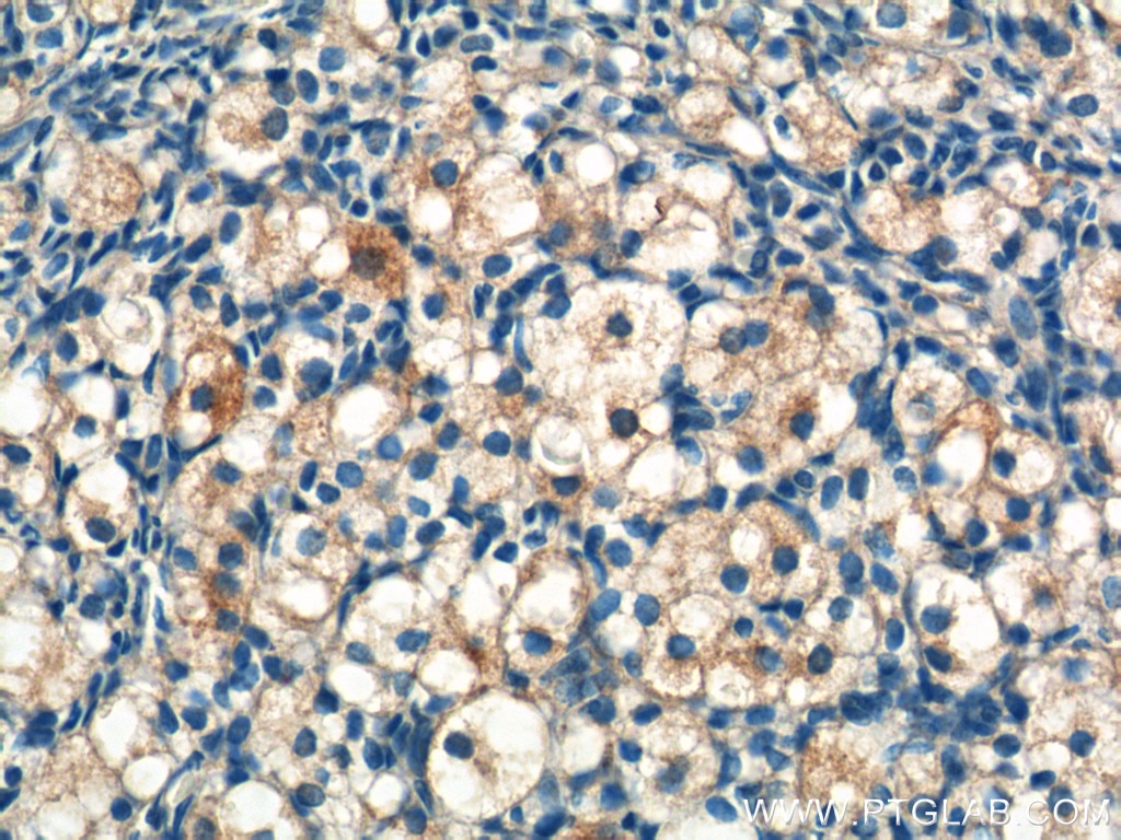 Immunohistochemistry (IHC) staining of human ovary tissue using STAR Polyclonal antibody (12225-1-AP)