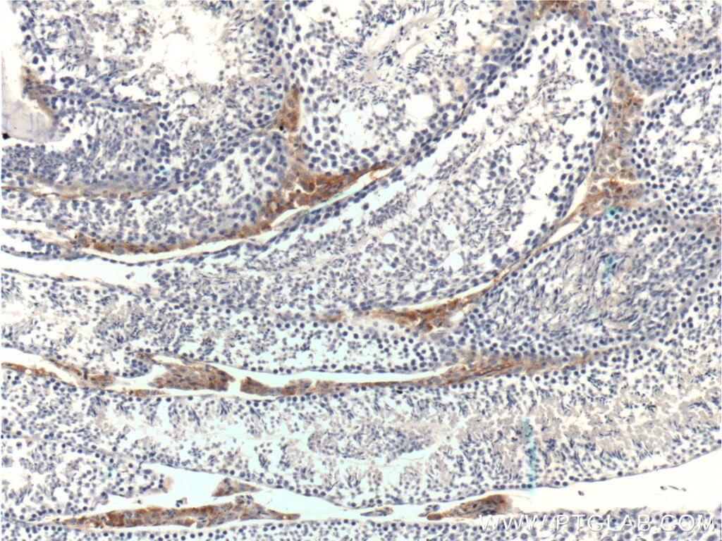 Immunohistochemistry (IHC) staining of mouse testis tissue using STAR Polyclonal antibody (12225-1-AP)