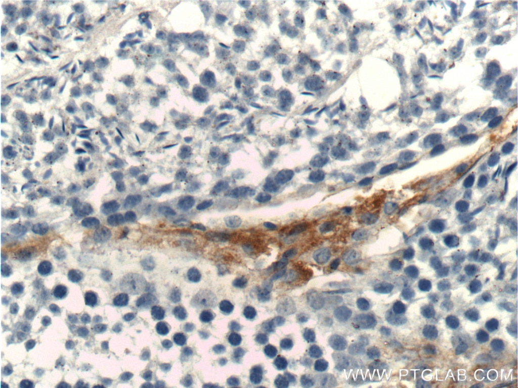 Immunohistochemistry (IHC) staining of mouse testis tissue using STAR Polyclonal antibody (12225-1-AP)