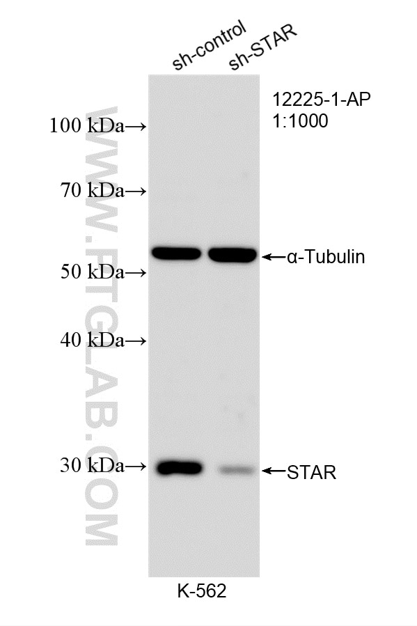 Western Blot (WB) analysis of K-562 cells using STAR Polyclonal antibody (12225-1-AP)
