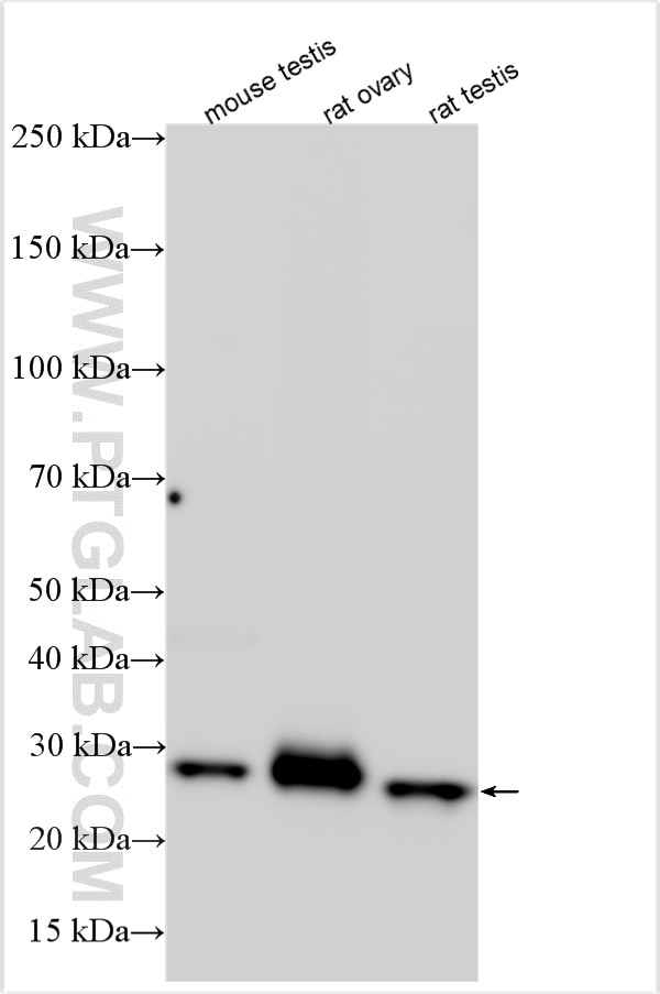 Western Blot (WB) analysis of various lysates using STAR Polyclonal antibody (12225-1-AP)