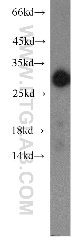 Western Blot (WB) analysis of human adrenal gland tissue using STAR Polyclonal antibody (12225-1-AP)