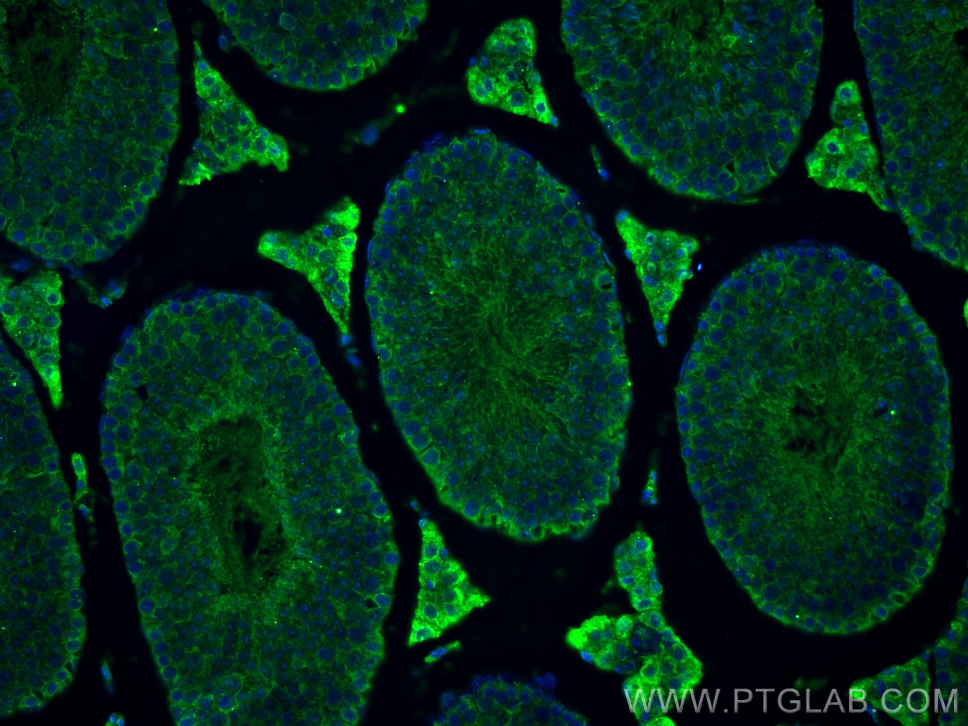 Immunofluorescence (IF) / fluorescent staining of mouse testis tissue using STAR Monoclonal antibody (67130-1-Ig)
