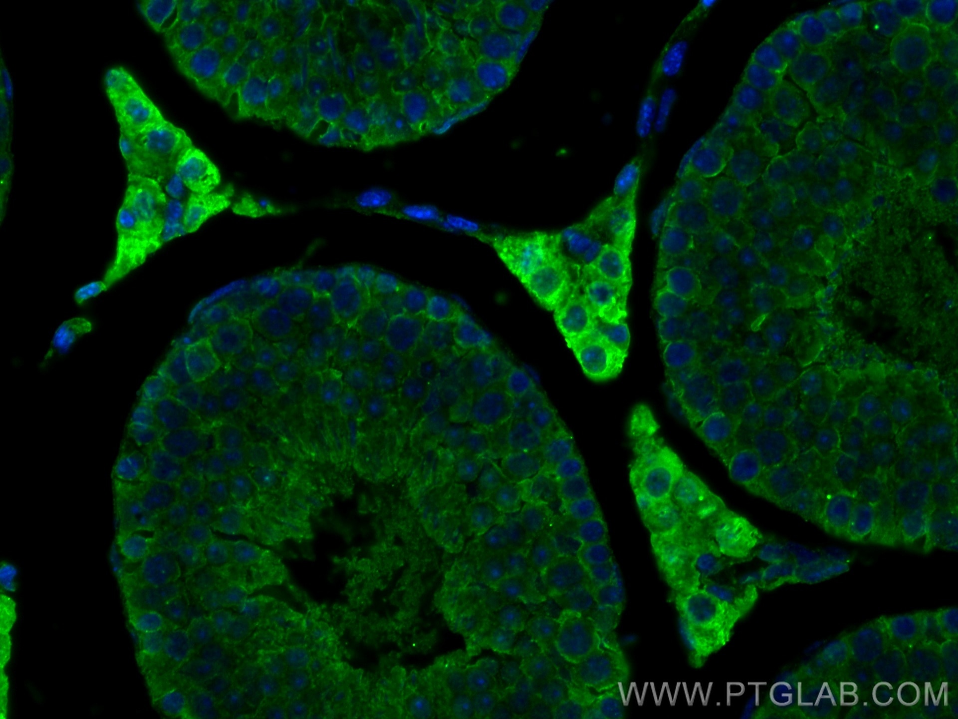 Immunofluorescence (IF) / fluorescent staining of mouse testis tissue using STAR Monoclonal antibody (67130-1-Ig)