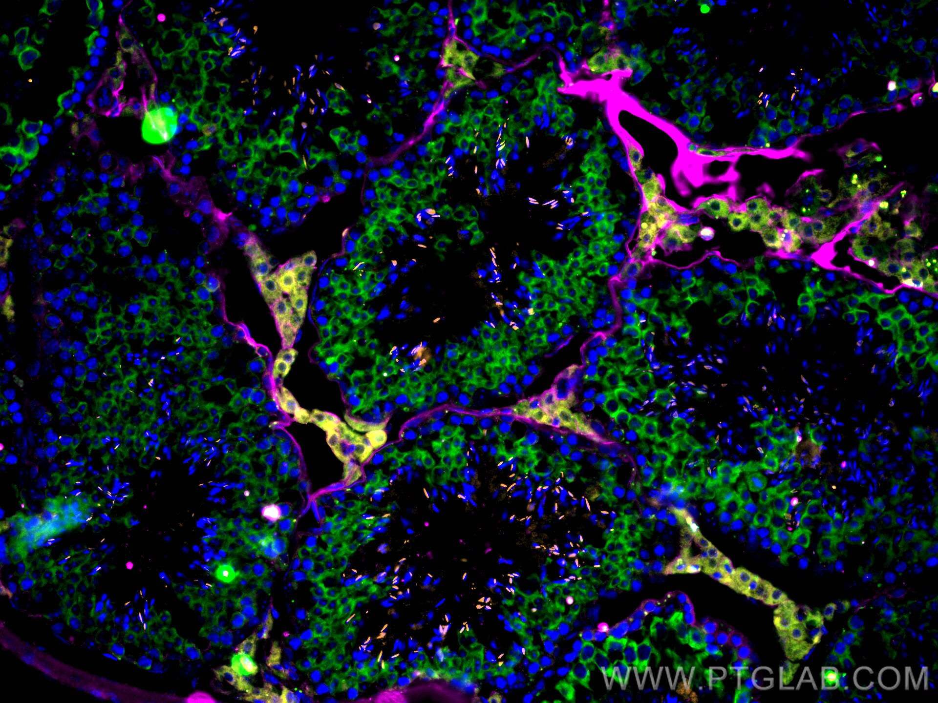 Immunofluorescence (IF) / fluorescent staining of mouse testis tissue using STAR Monoclonal antibody (67130-1-Ig)