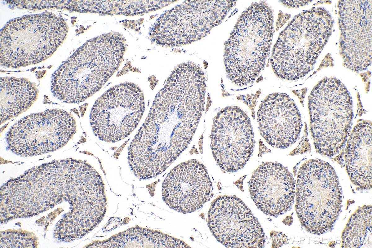 IHC staining of mouse testis using 80751-1-RR